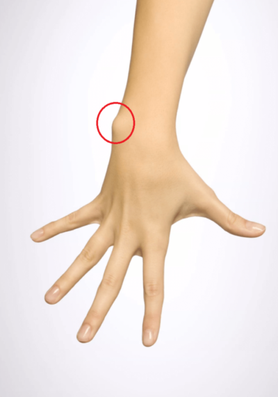 Sleeve length