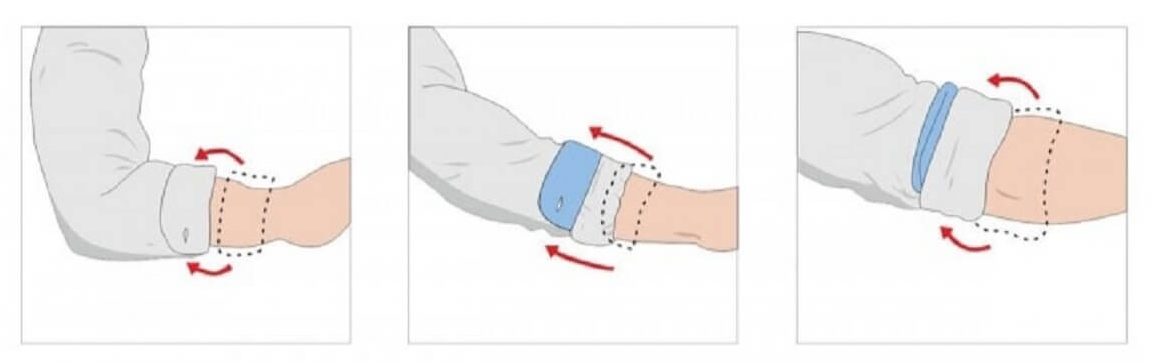 Italian sleeves